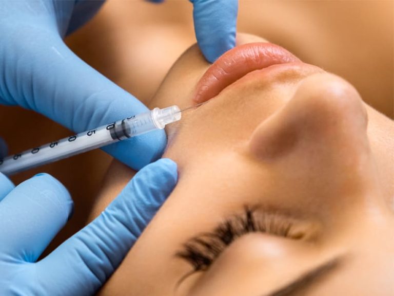 Patient receiving injection of dermal fillers in the lip area