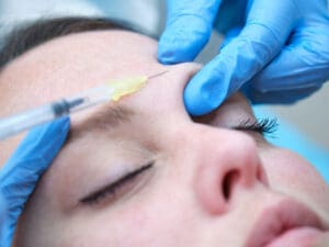 Botulinum injection in brow to illustrate benefits of Botox