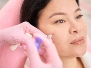 Lady undergoing rejuvenation procedure to illustrate Botox and fillers
