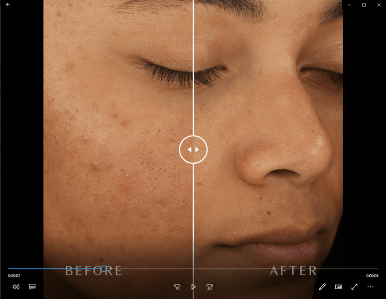 Before-and-After-Video-2-min