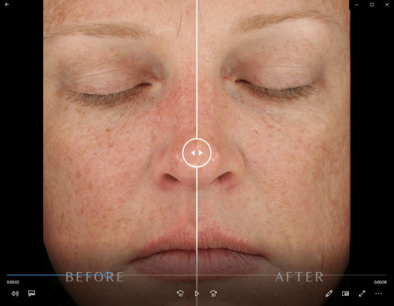 Before-and-After-Video-3-min